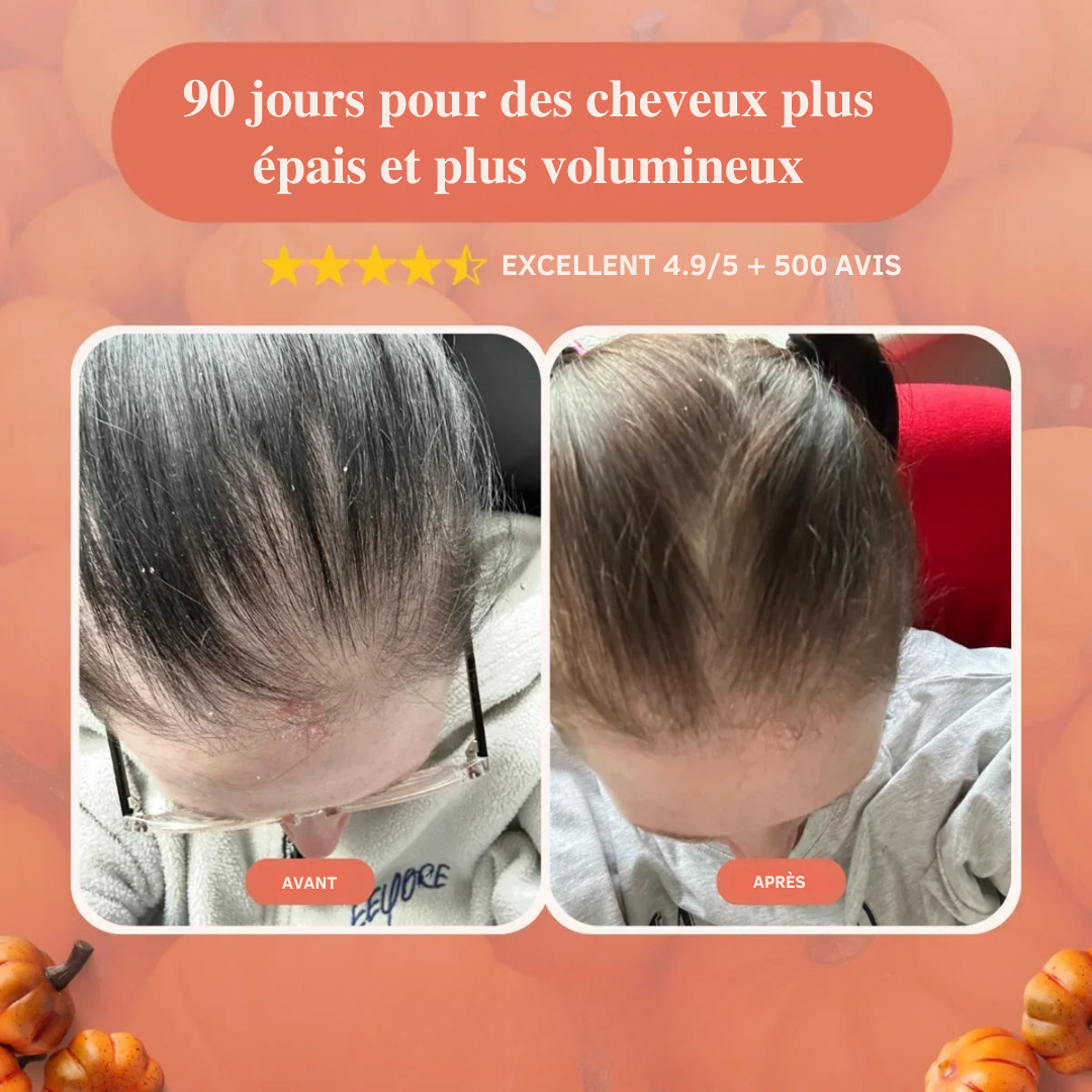 Elyra- Gélules Huile de graine de Courge