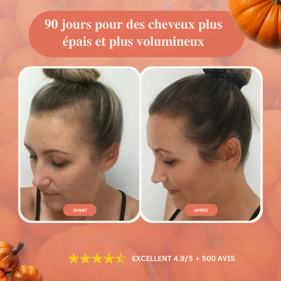 Elyra- Gélules Huile de graine de Courge