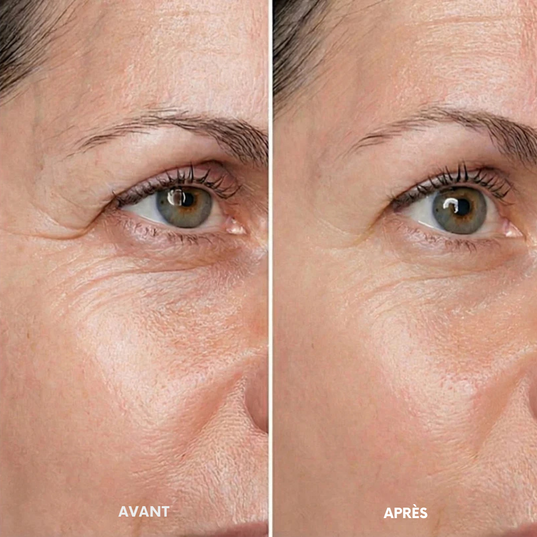 Elyra- Soin liftant aux peptides