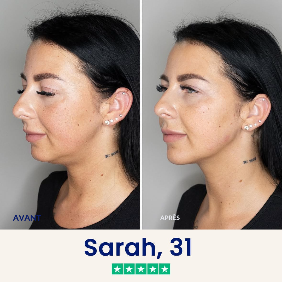 Elyra- Masque Liftant Coréen